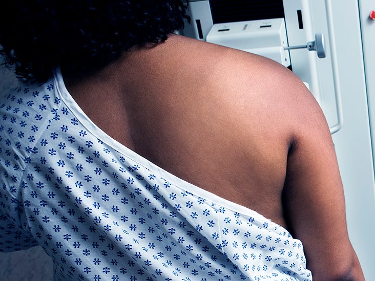 Breast Calcifications Causes When To See A Doctor And Diagnosis