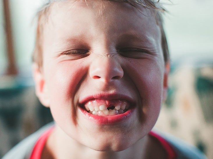 Deciduous Teeth Also Known As Primary Or Baby Teeth