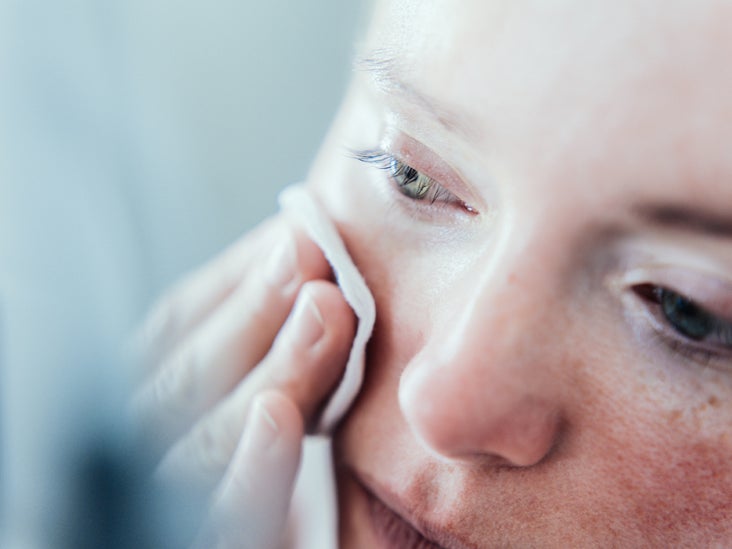 Zinc Deficiency Dermatitis