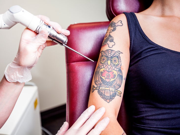 Tattoo Infection Symptoms And Treatment