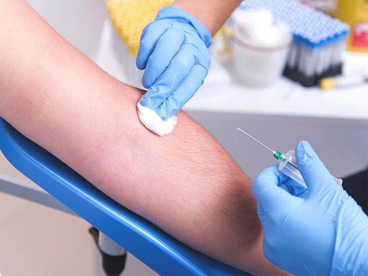 Hcv Rna Pcr Quantitative Test Results