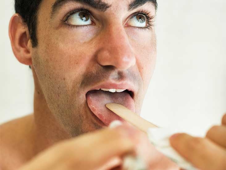 Recurring Thrush Causes Treatment And Prevention