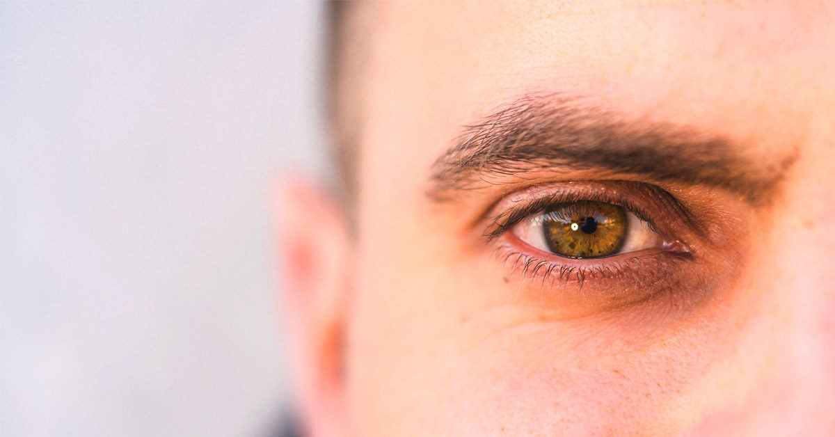Eye Freckles Causes Symptoms Complications And Treatments