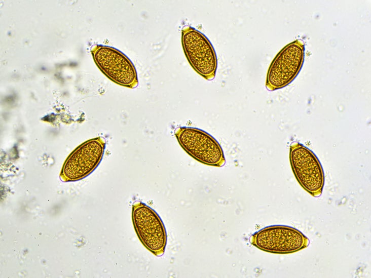A trichocephalosis geohelmint