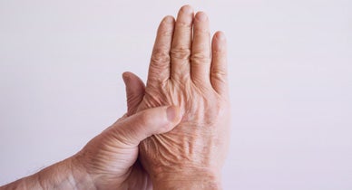 Basal Joint Arthritis Symptoms And Treatment