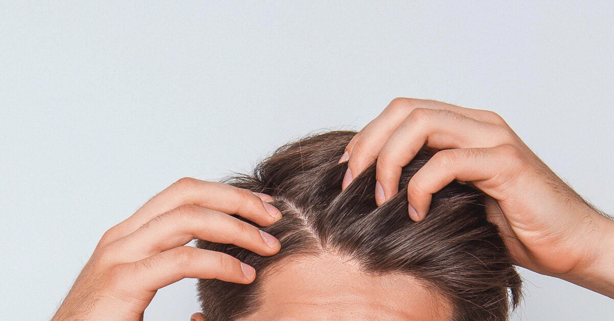 itchy scalp red spots