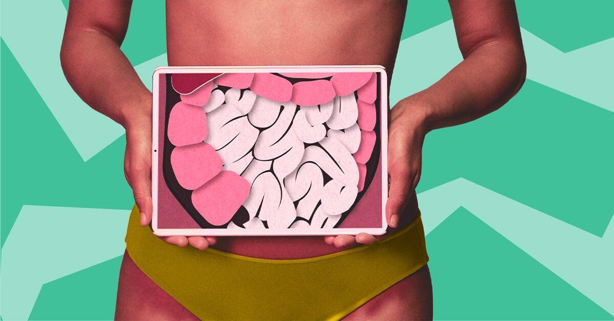 IBS vs. Crohn’s vs. Ulcerative Colitis: Symtoms and Treatment