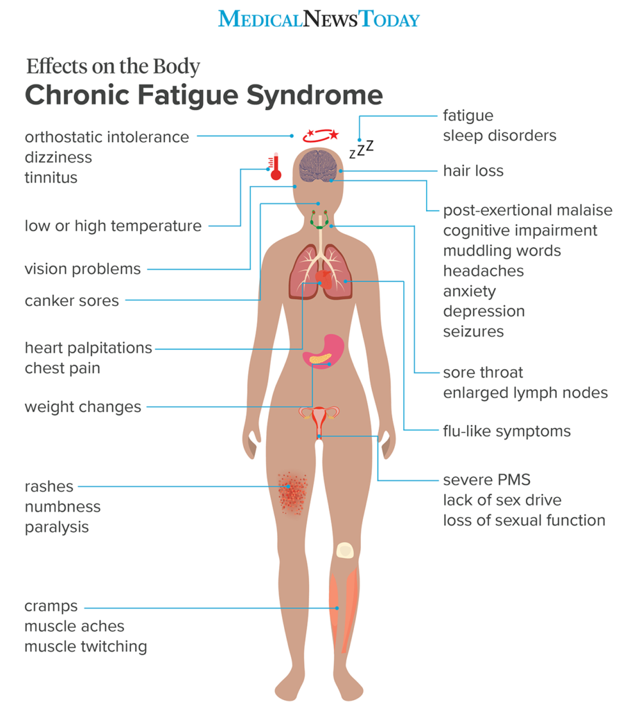 Chronic Fatigue Syndrome As Related To Headache Pictures