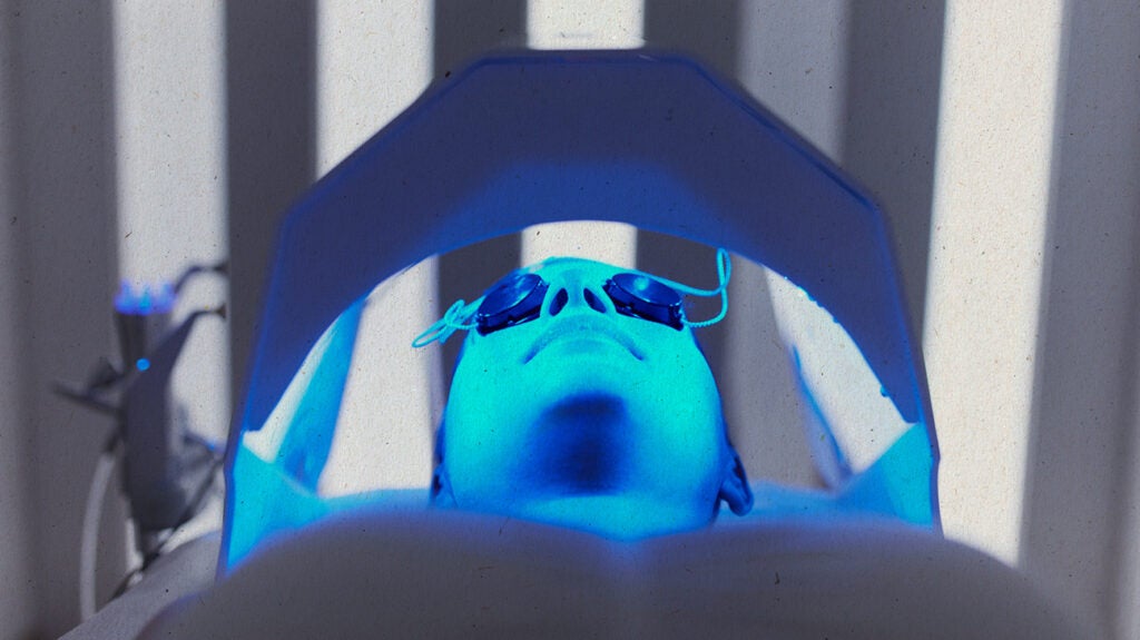 Blue light therapy for acne: Benefits, side effects, and costs