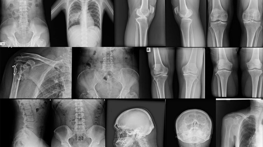 Bones: Structure and Types 