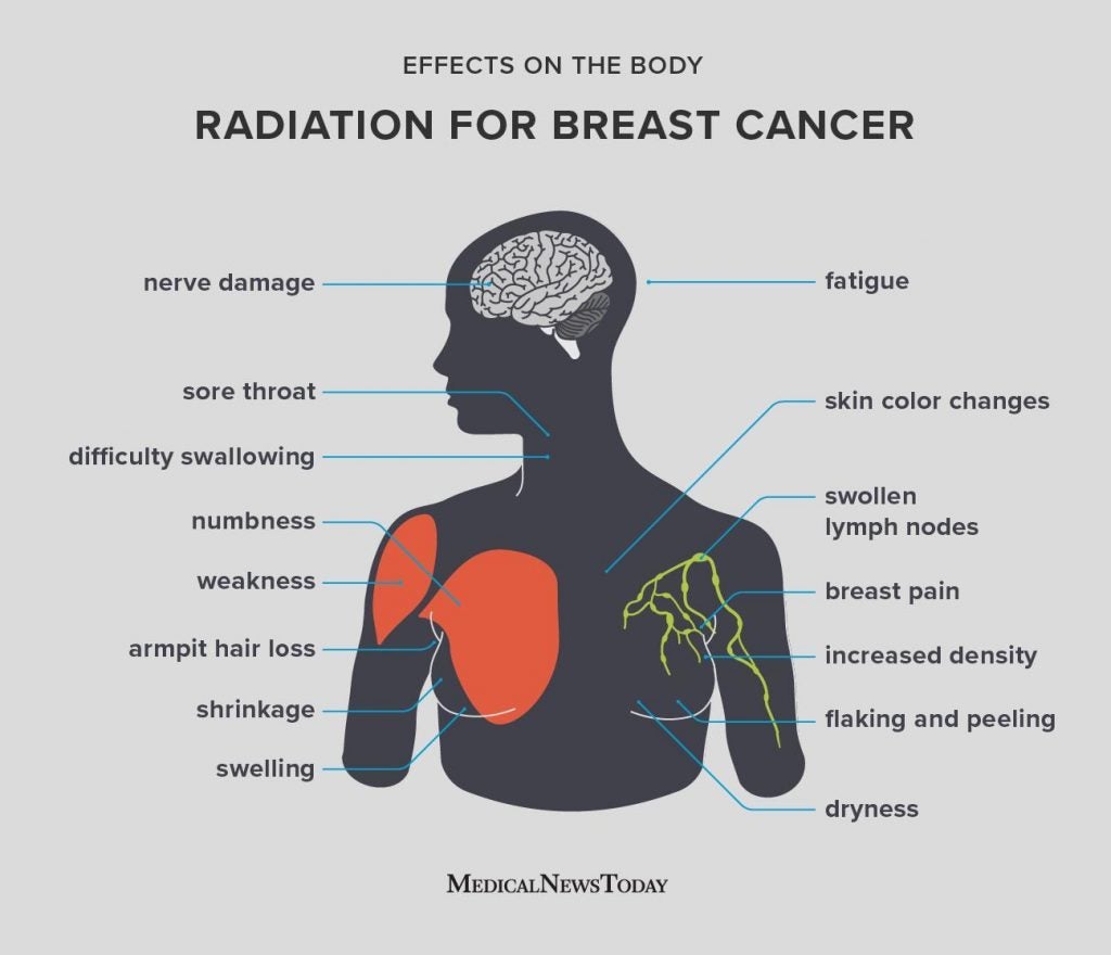 Side effects of radiation for breast cancer What to know