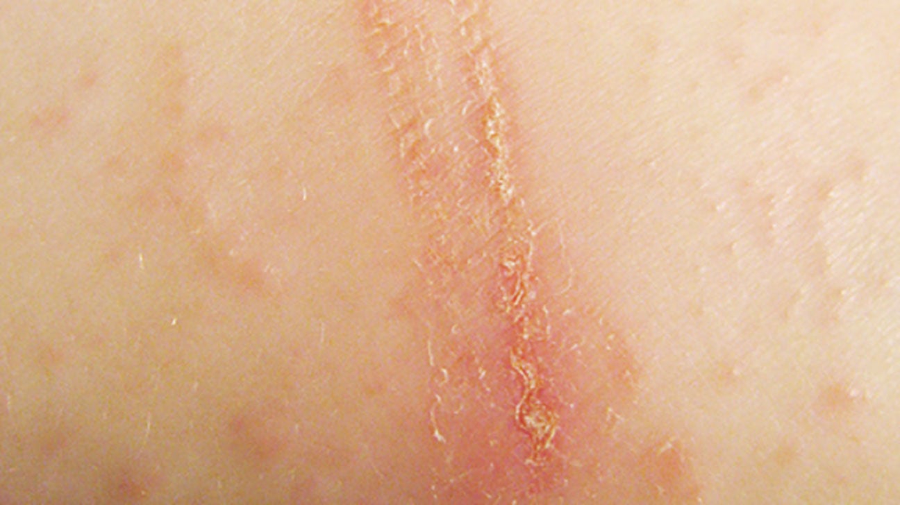 Is your skin rash an STD rash?. Any change in the genital area invites…, by CupidCare