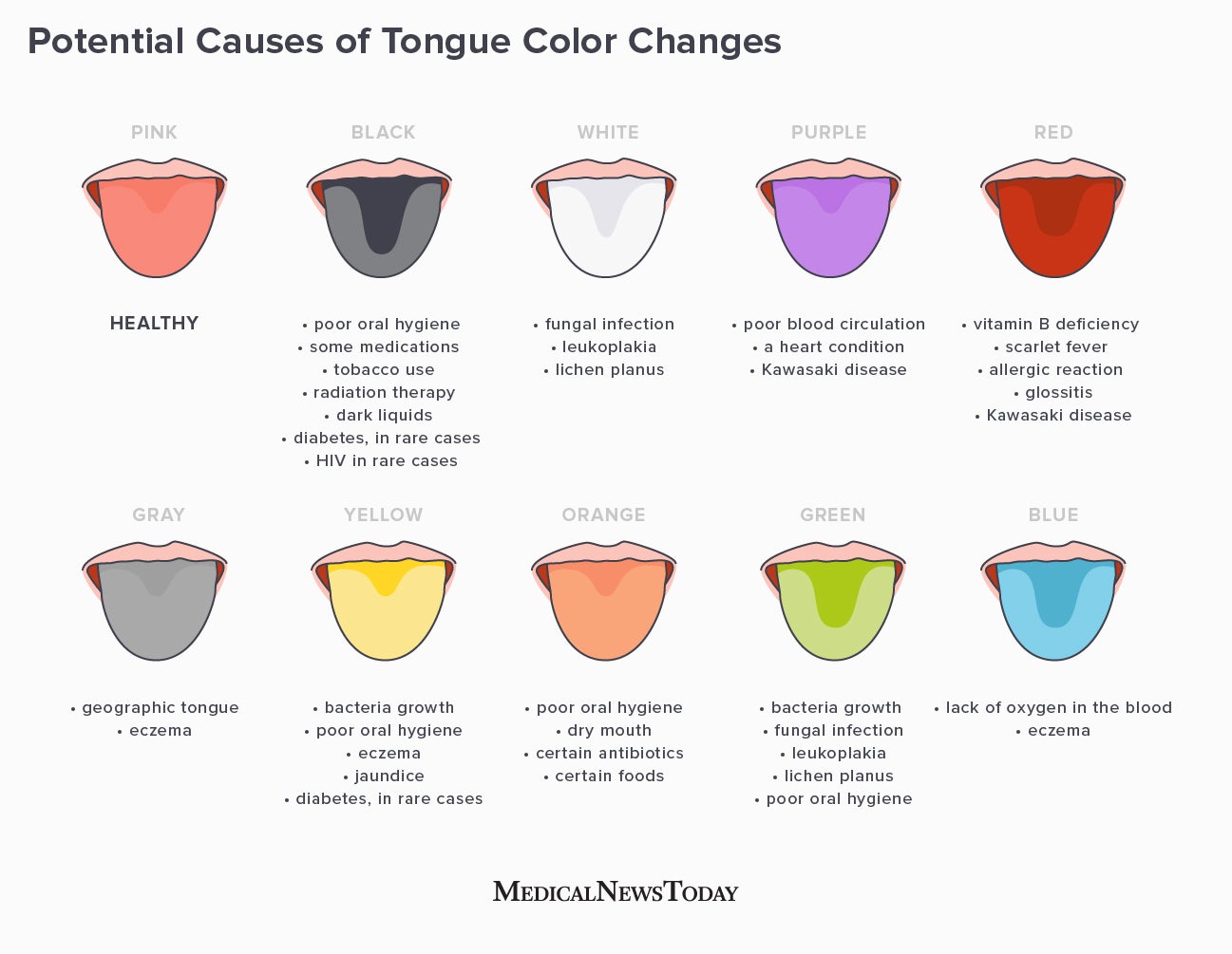 Tongue color What does it say about health?