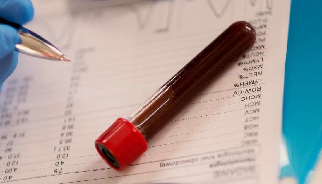 How long does it take to receive blood test results? A guide