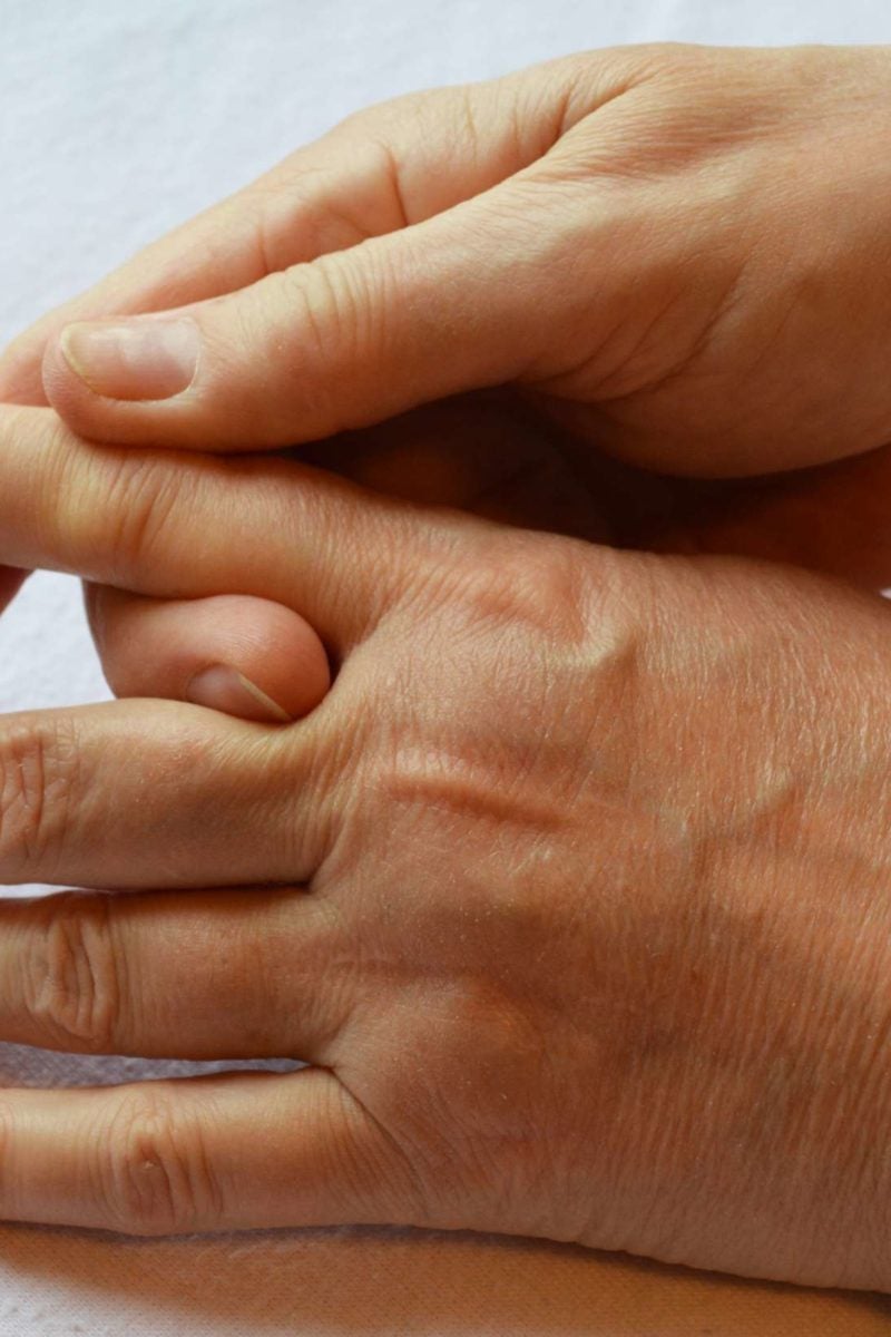 stiff-fingers-causes-treatment-and-stretches