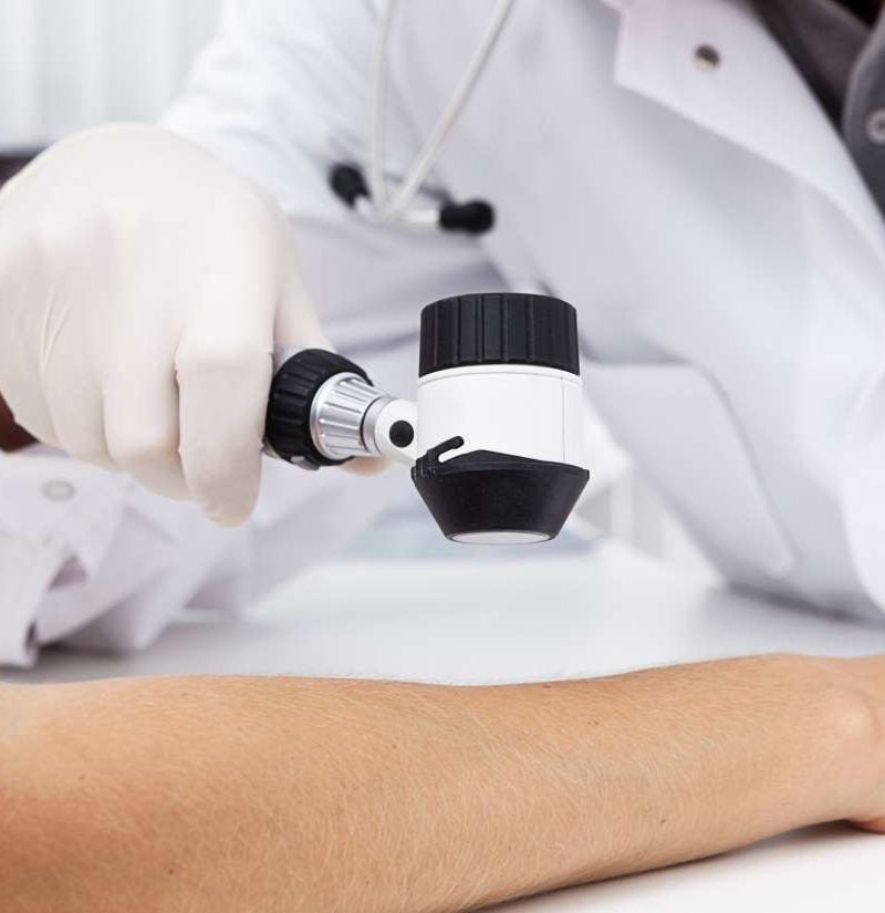 This vitamin D mechanism helps combat melanoma