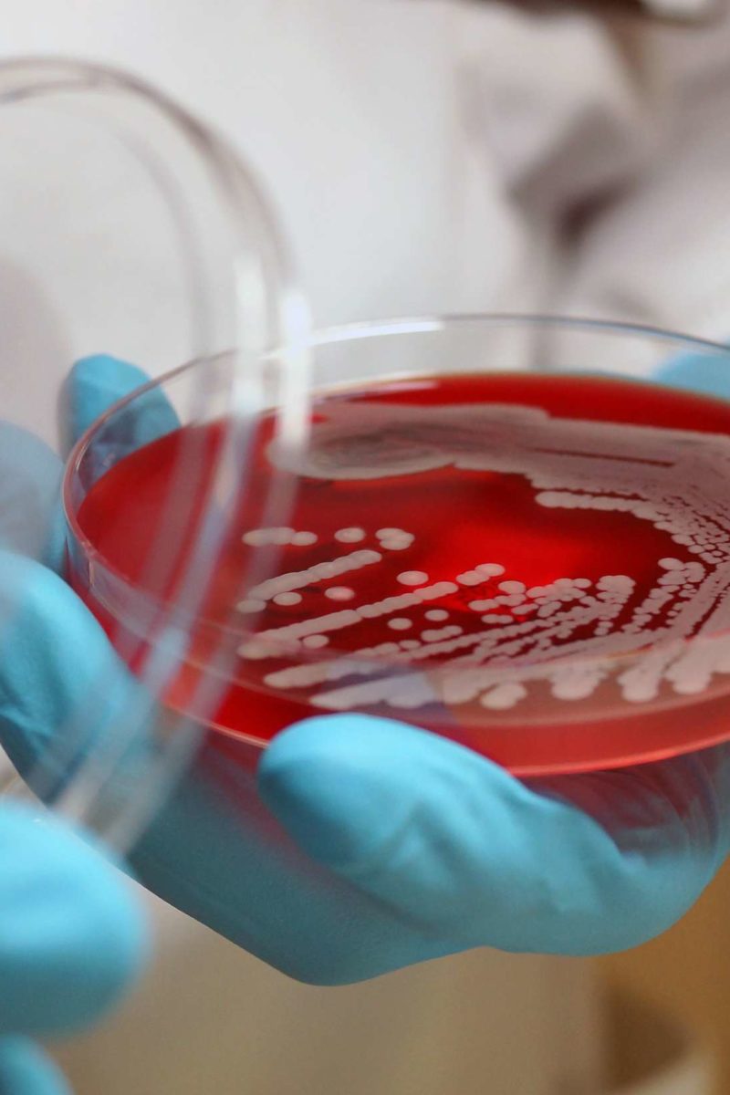 Superbugs: What they are, evolution, and what to do