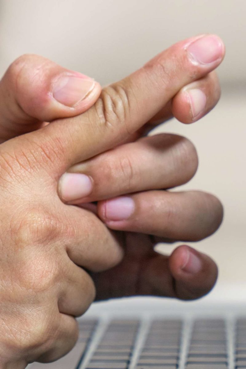 Trigger Finger: Causes, Symptoms, & Treatment