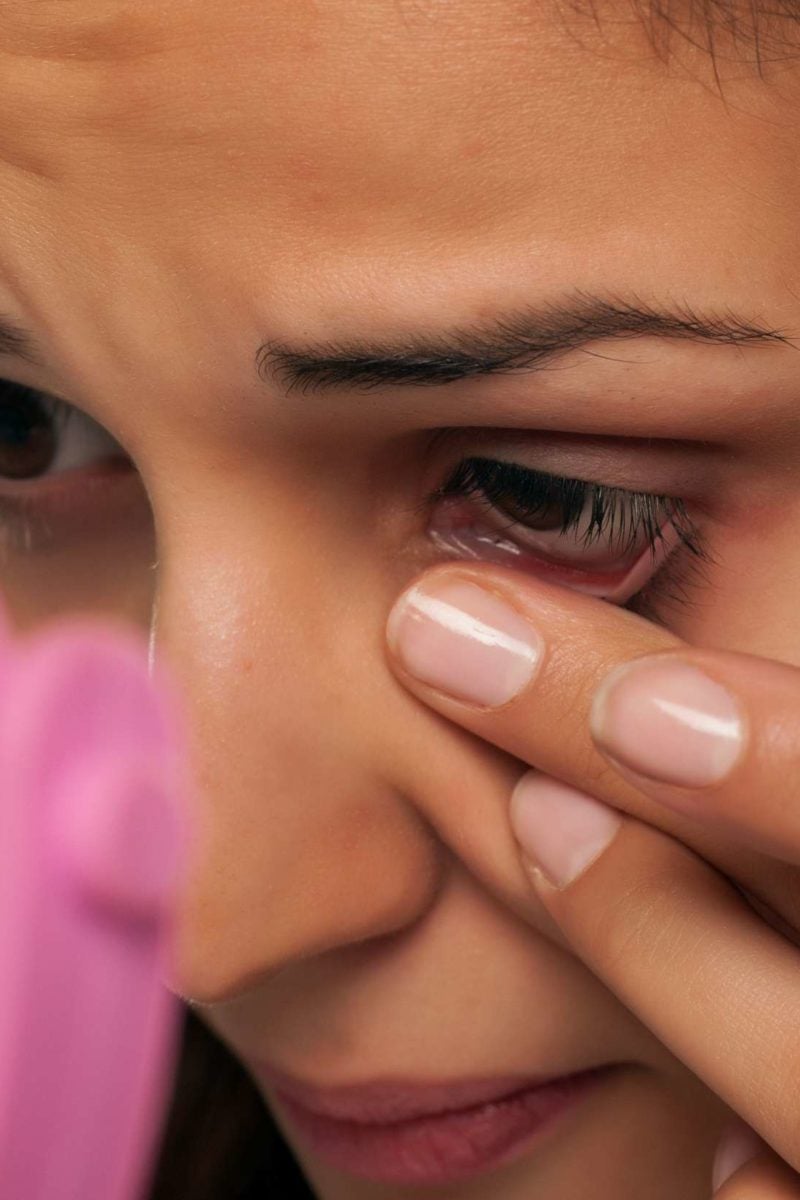 remove skin tags on eyelids naturally