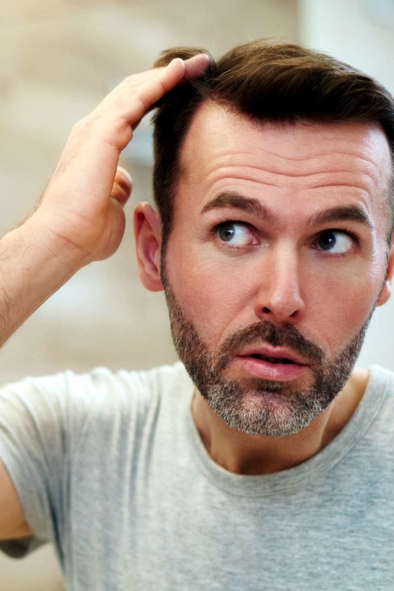 How much hair loss is normal? Brushing, washing, and more