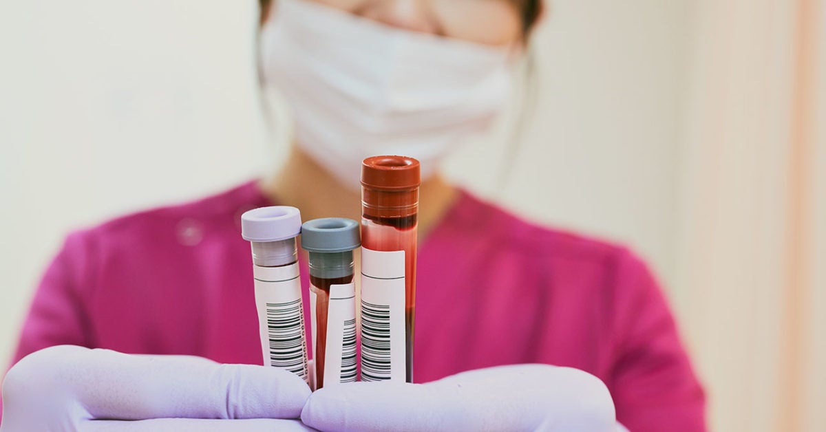 Blood tests Types, routine testing, results, and more