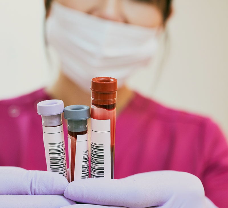 Blood Tests Types Routine Testing Results And More