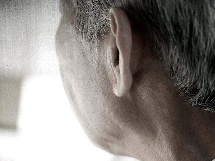 Headache Behind The Ear Signs Causes And Treatments