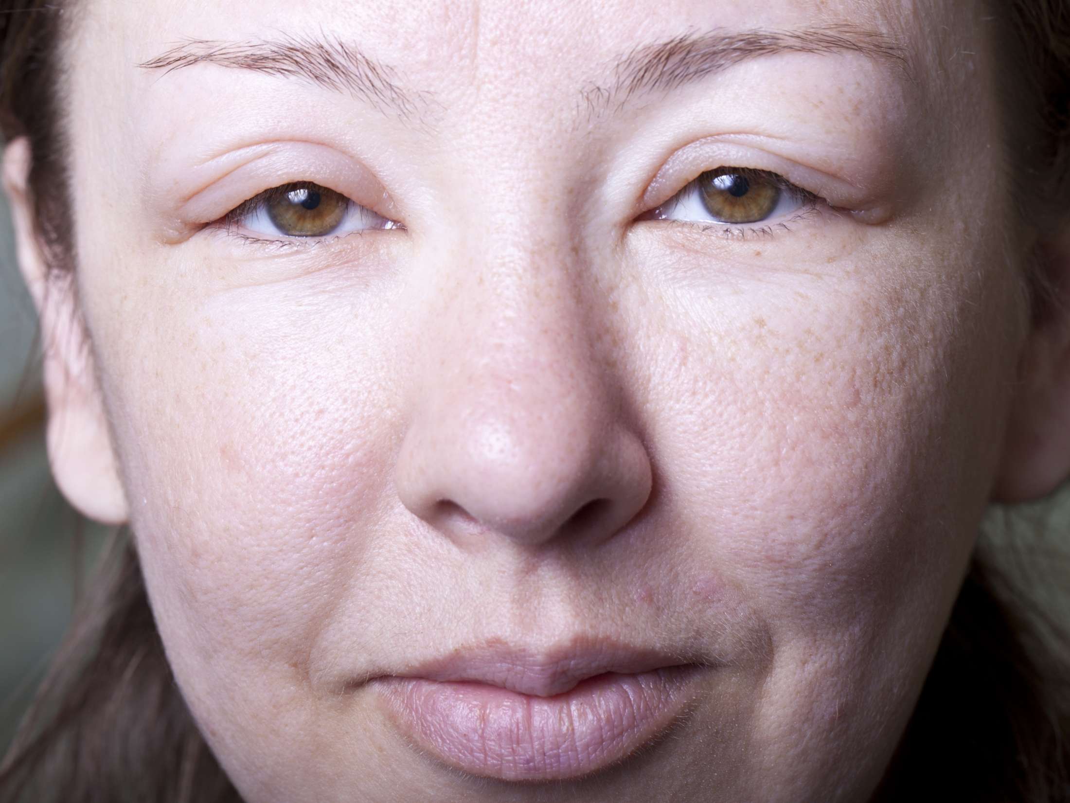 Face Swelling Causes Treatment And When To See A Doctor