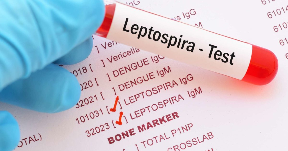 Leptospirosis: Treatment, symptoms, and types