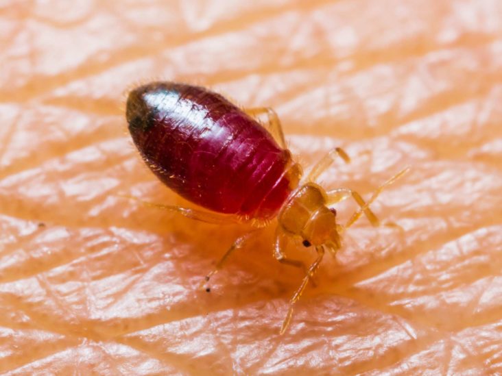 scabies bed bugs