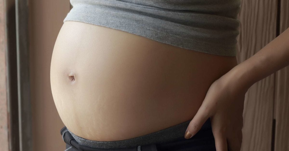 20 Weeks Pregnant Symptoms Hormones And Baby Development.
