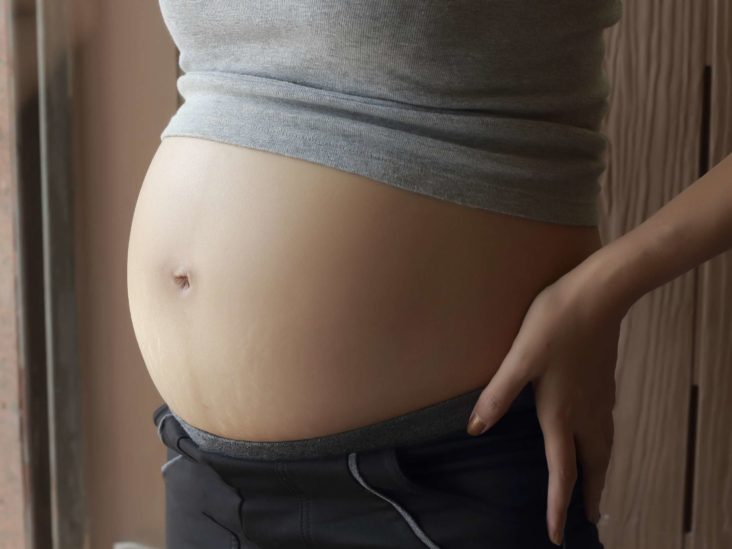 20 weeks pregnant Symptoms, hormones, and baby development image
