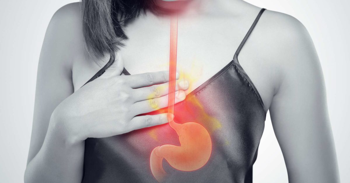 Can Acid Reflux Cause Chronic Sore Throat