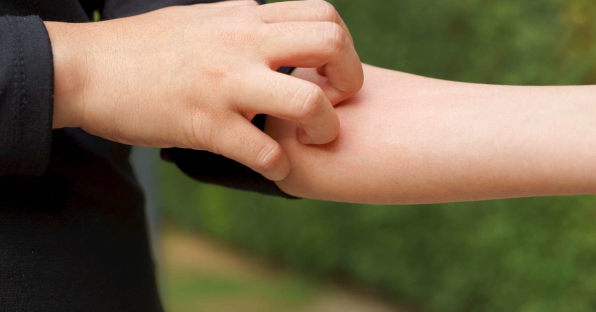 Is Itchy Hands A Symptom Of Diabetes