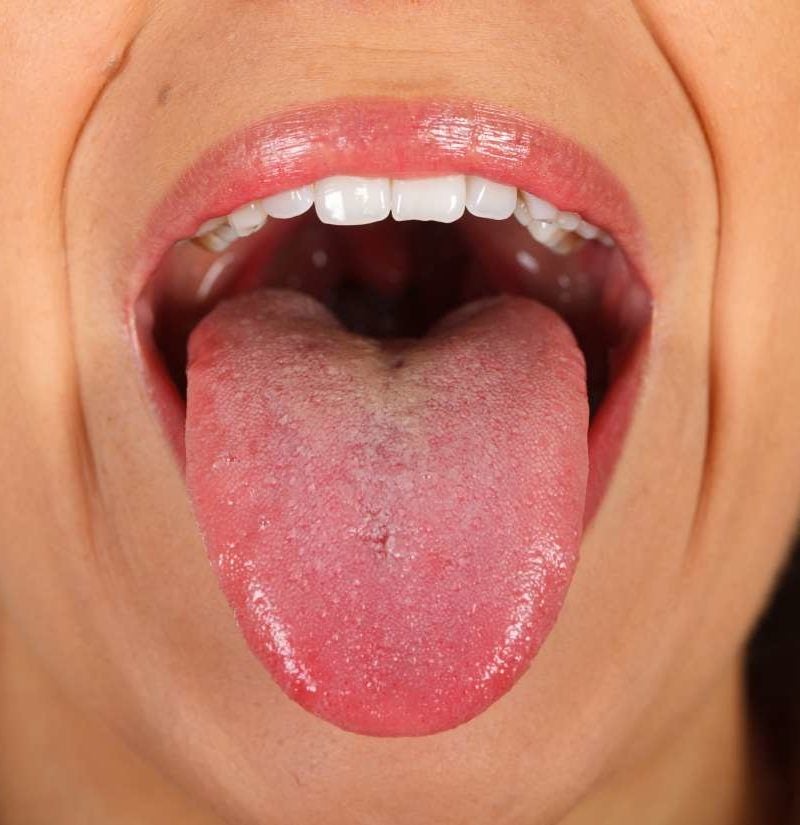 mouth with bacteria in it