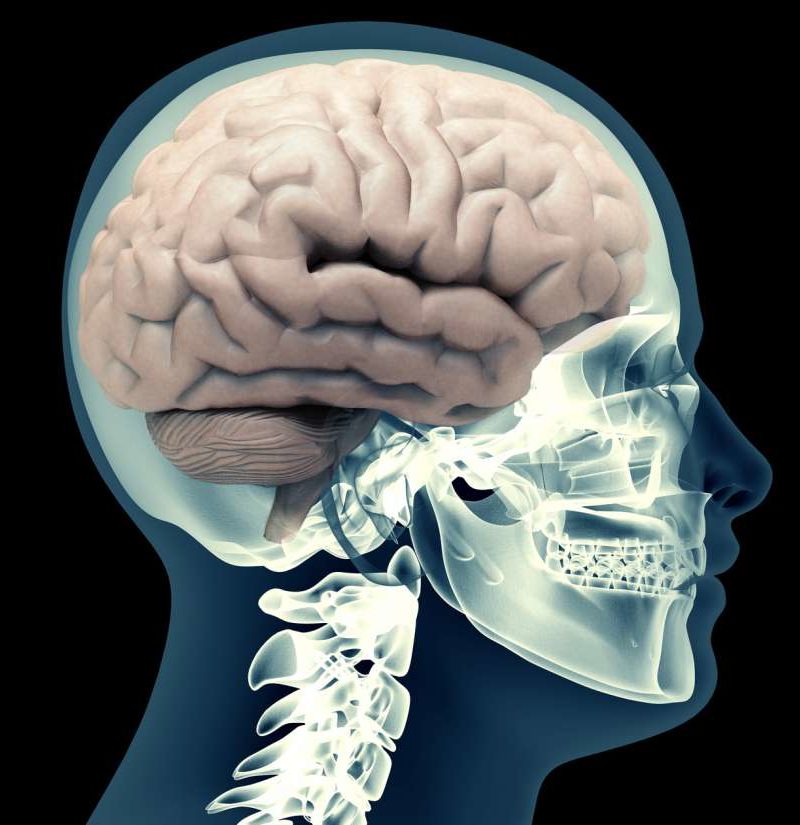 Intracerebral Hemorrhage Symptoms Risk Factors And Treatment