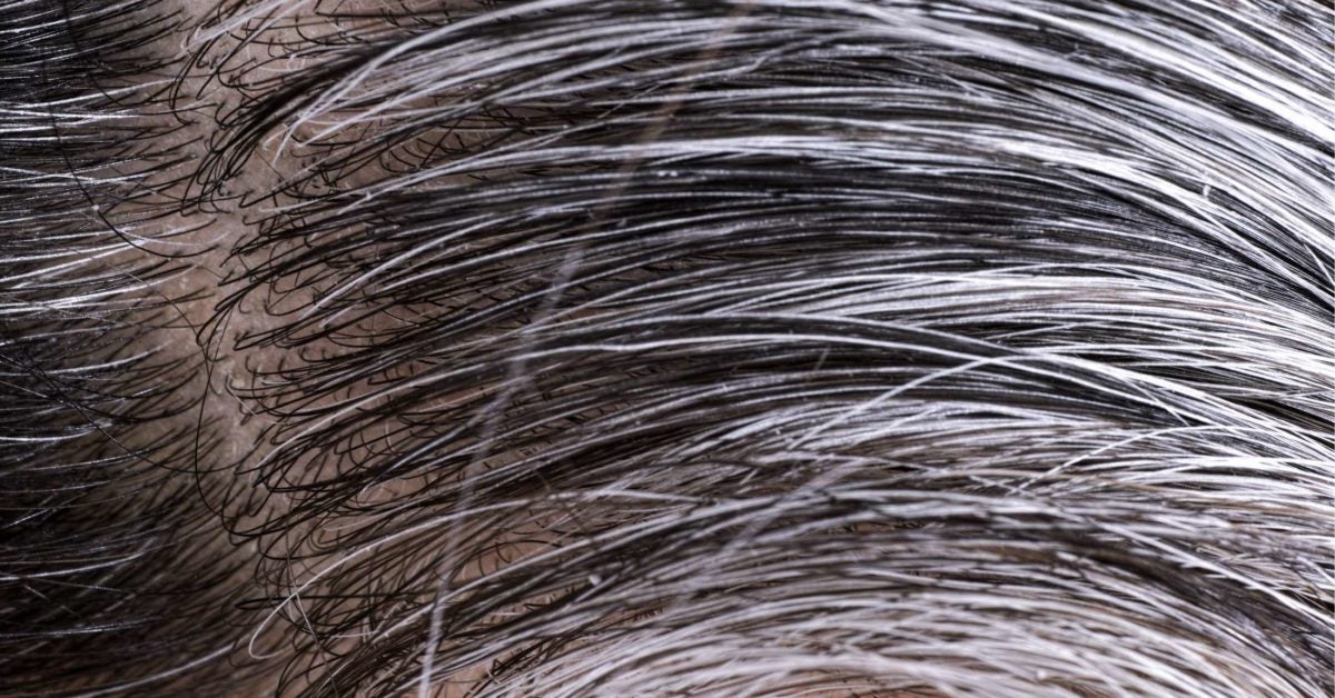 How to Stop Gray Hair Naturally