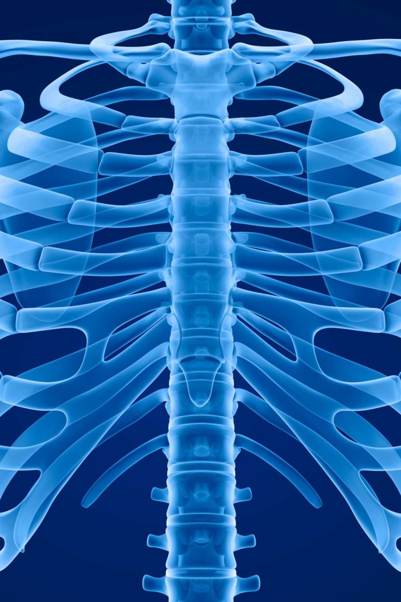 slipping-rib-syndrome-causes-treatment-and-diagnosis