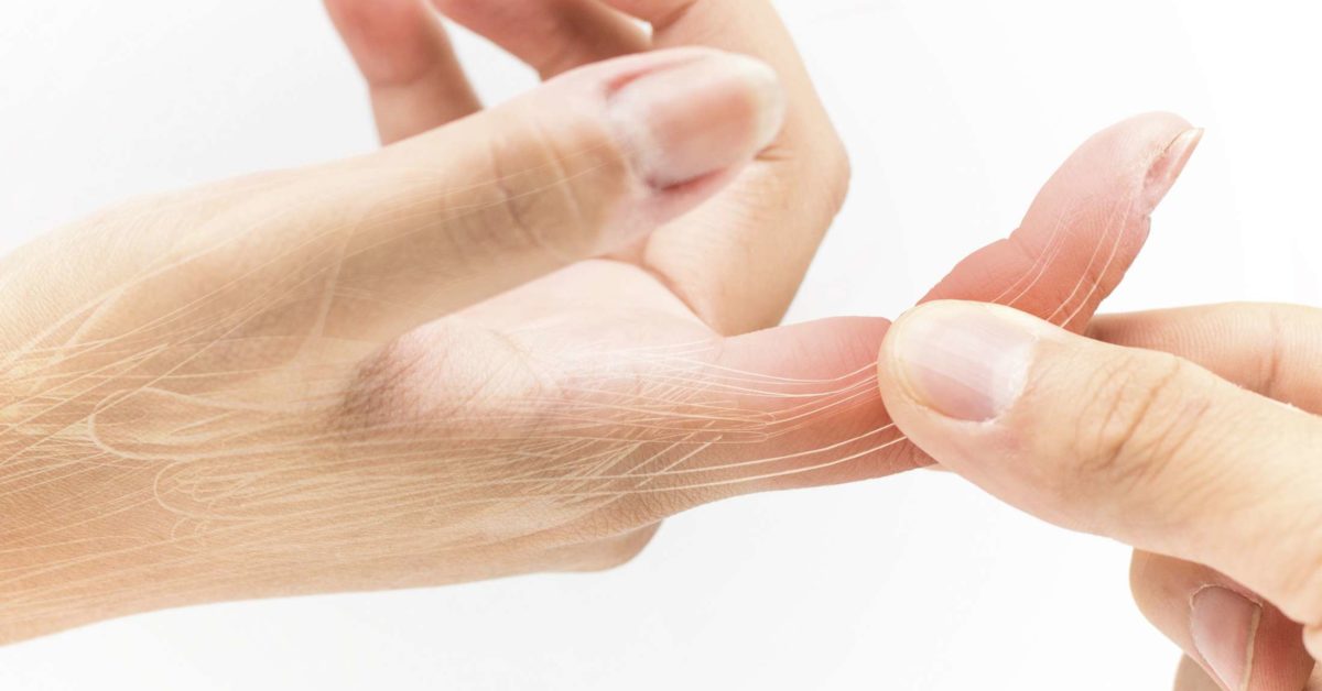 Sprained Finger Symptoms Treatment And Recovery