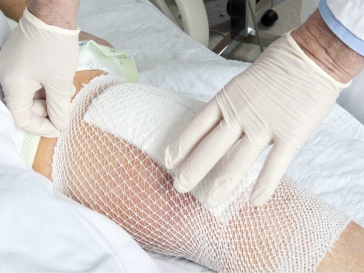 How to get rid of swelling in knee after surgery Knee Replacement Infection Symptoms And Risk Factors