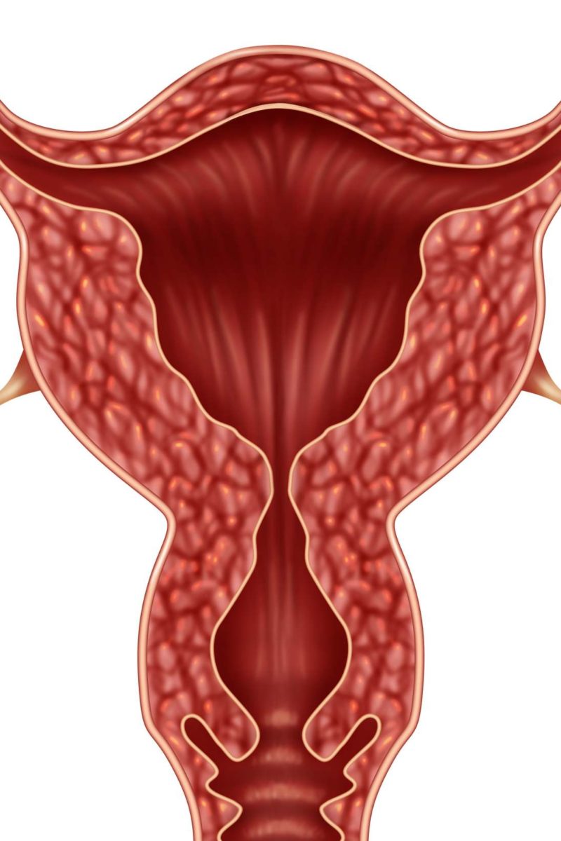 Risks Of Unilateral Oophorectomy