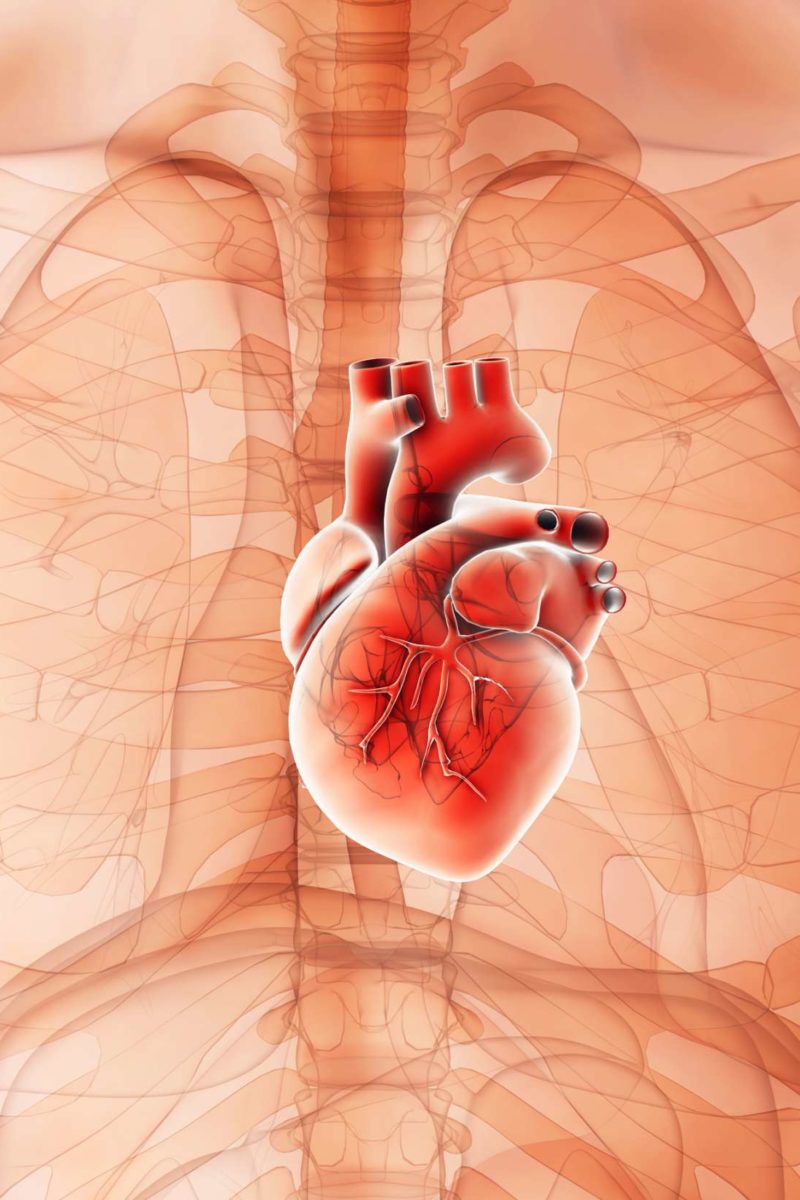 Cardiomegaly: Diagnosis, treatment, and prevention