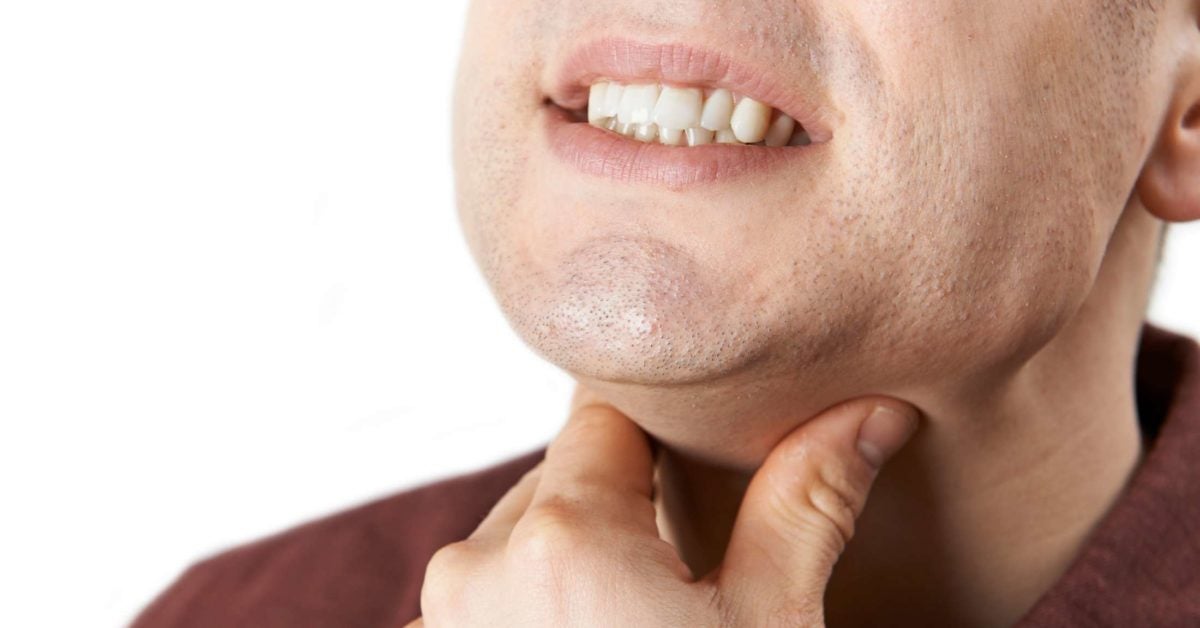 Throat ulcers Causes, symptoms, and treatment