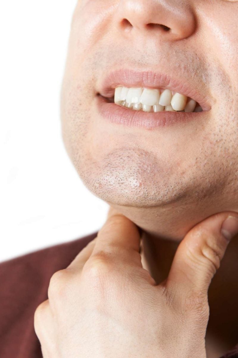 Throat Ulcers Causes Symptoms And Treatment