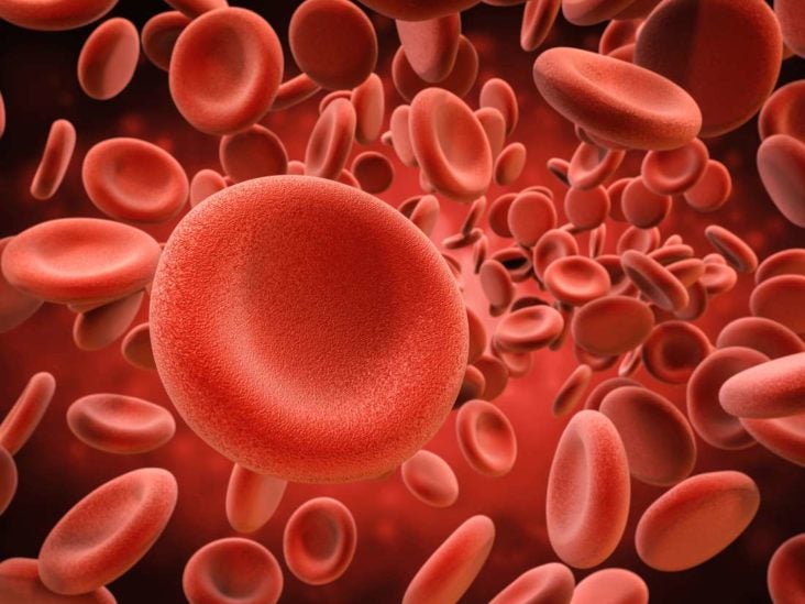 Microcytic anemia: Symptoms, types, and treatment