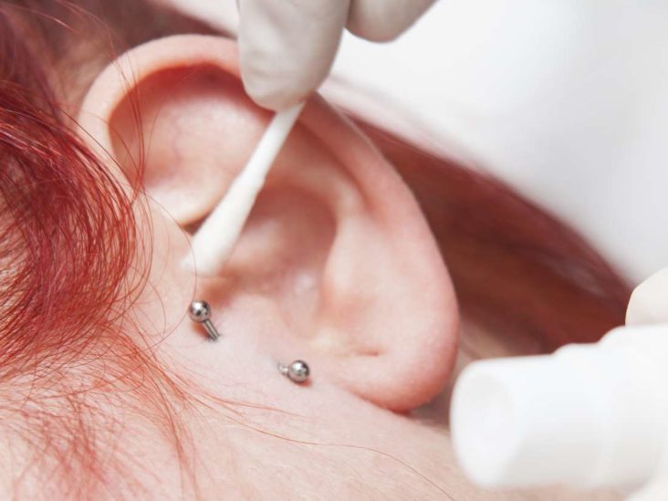 rook piercing keloid