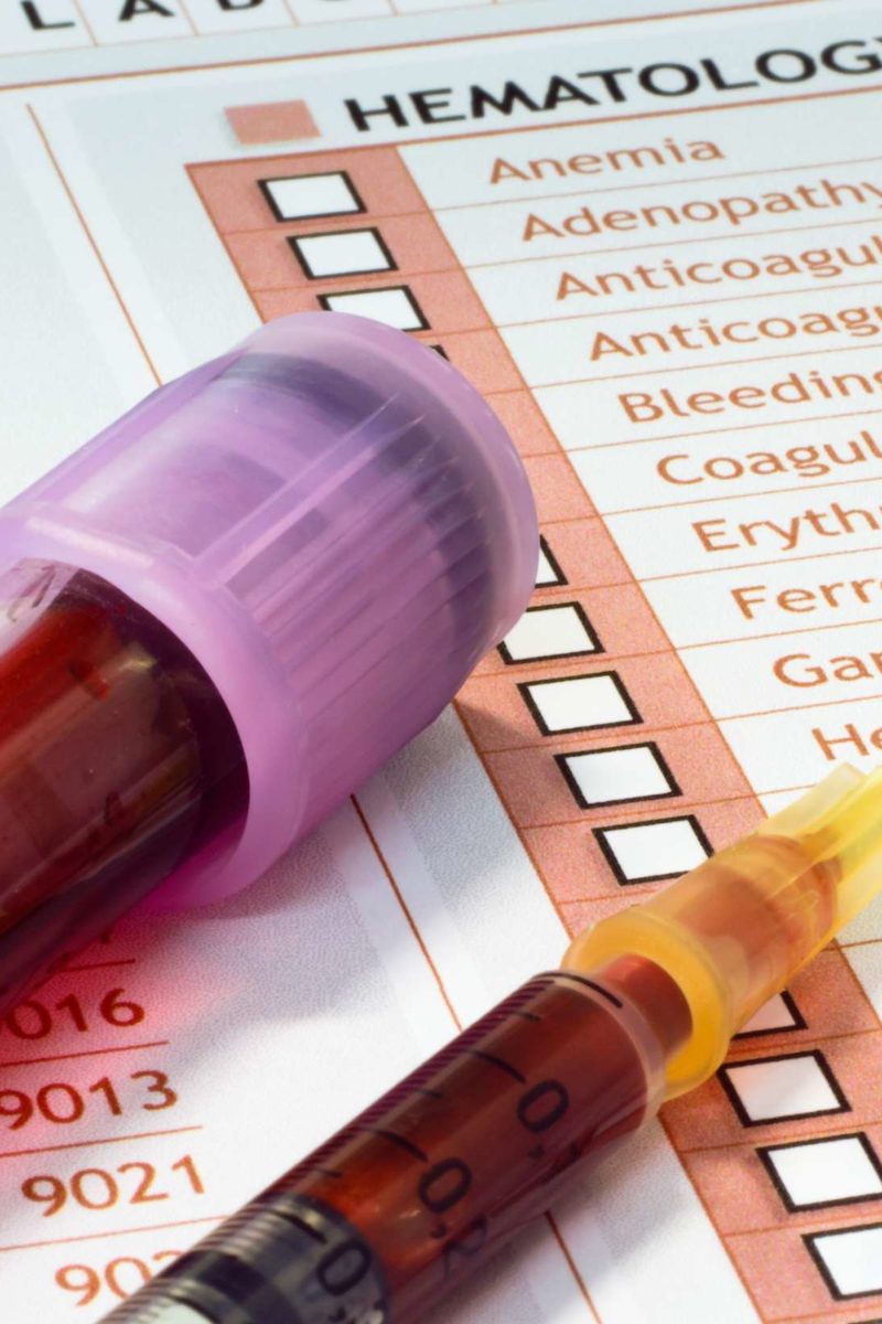 Hepatitis C antibody test Results and what to expect