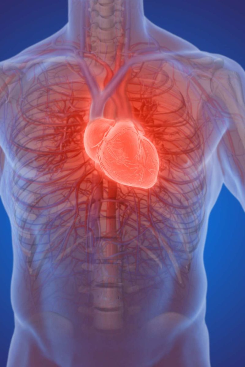 Who is most at risk after a heart attack?