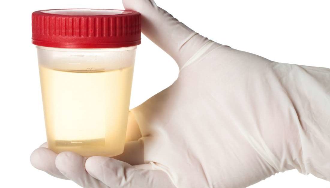 Urine Smells Like Ammonia