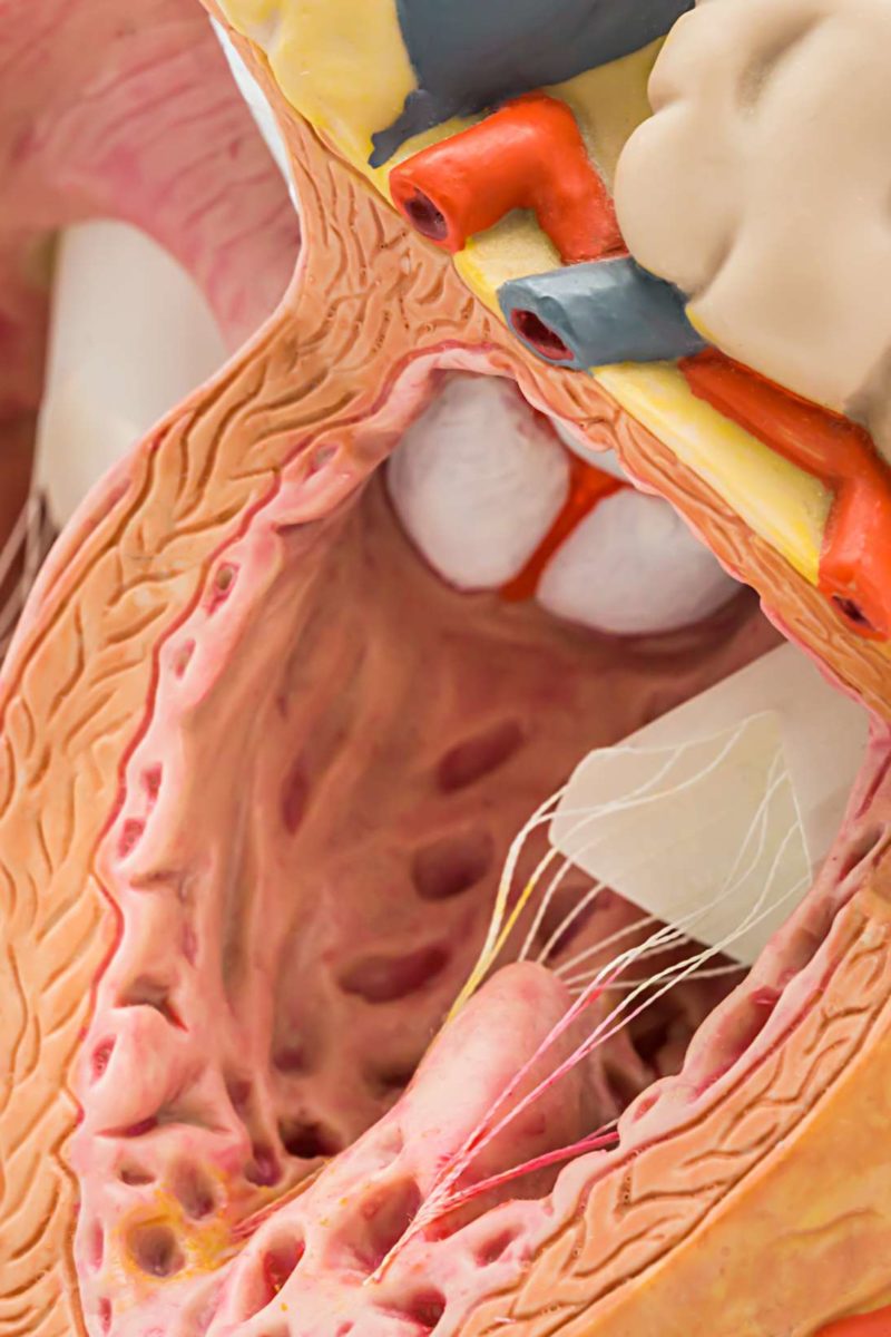 Psoriasis drug may lower heart disease risk